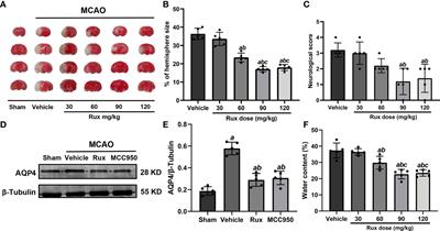 Janus Kinase Inhibition Ameliorates Ischemic Stroke Injury and Neuroinflammation Through Reducing NLRP3 Inflammasome Activation via JAK2/STAT3 Pathway Inhibition